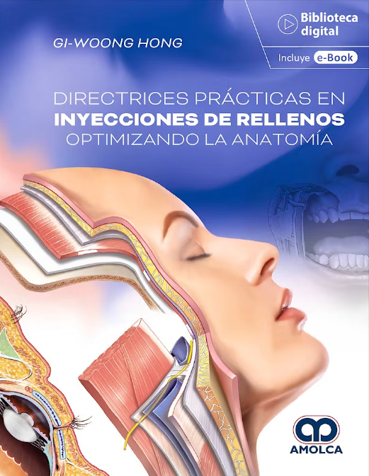 DIRECTRICES PRACTICAS EN INYECCIONES DE RELLENOS