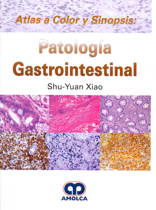 Atlas a Color y Sinopsis: Patología Gastrointestinal