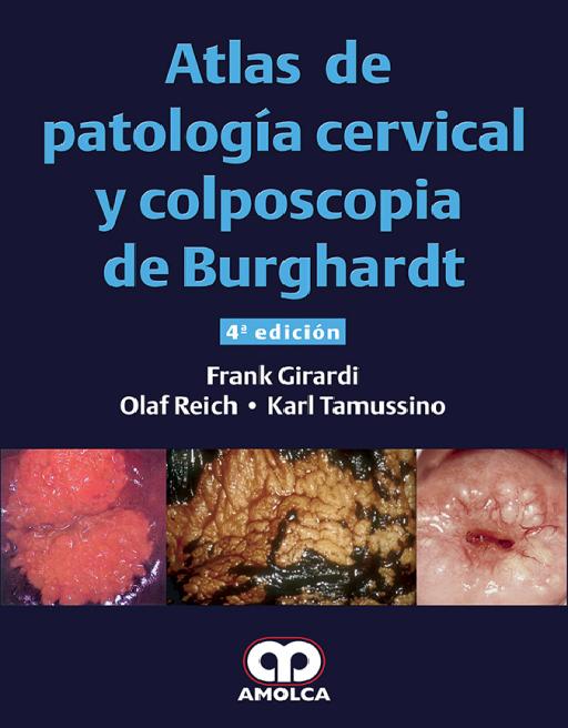 Atlas de Patología Cervical y Colposcopia de Burghardt