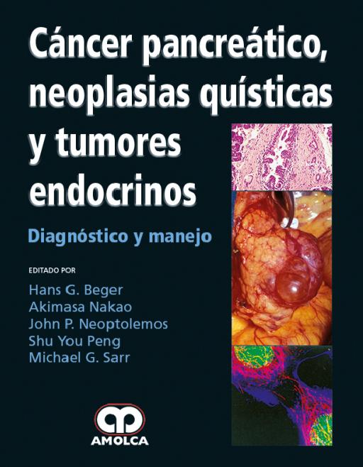 Cáncer Pancreático, Neoplasias Quísticas y Tumores Endócrinos.