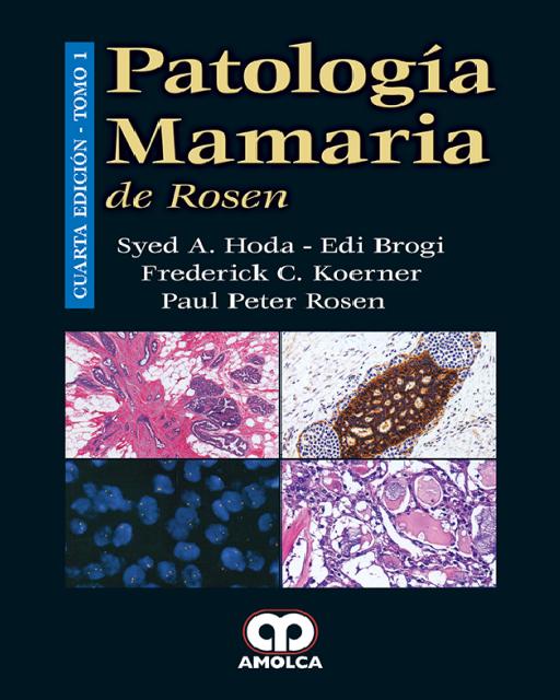Patología Mamaria de Rosen