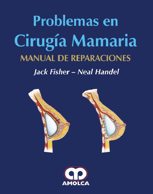Problemas en Cirugía Mamaria Manual de reparaciones