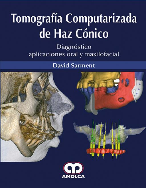 Tomografía Computarizada de Haz Cónico
Diagnóstico, aplicaciones oral y maxilofacial