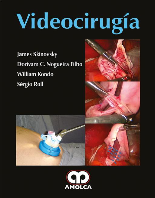 Video Cirugía